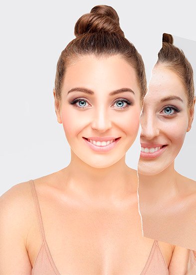 Как использовать консилер для лица