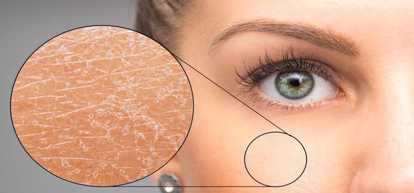 Чем мазать лицо от шелушения кожи