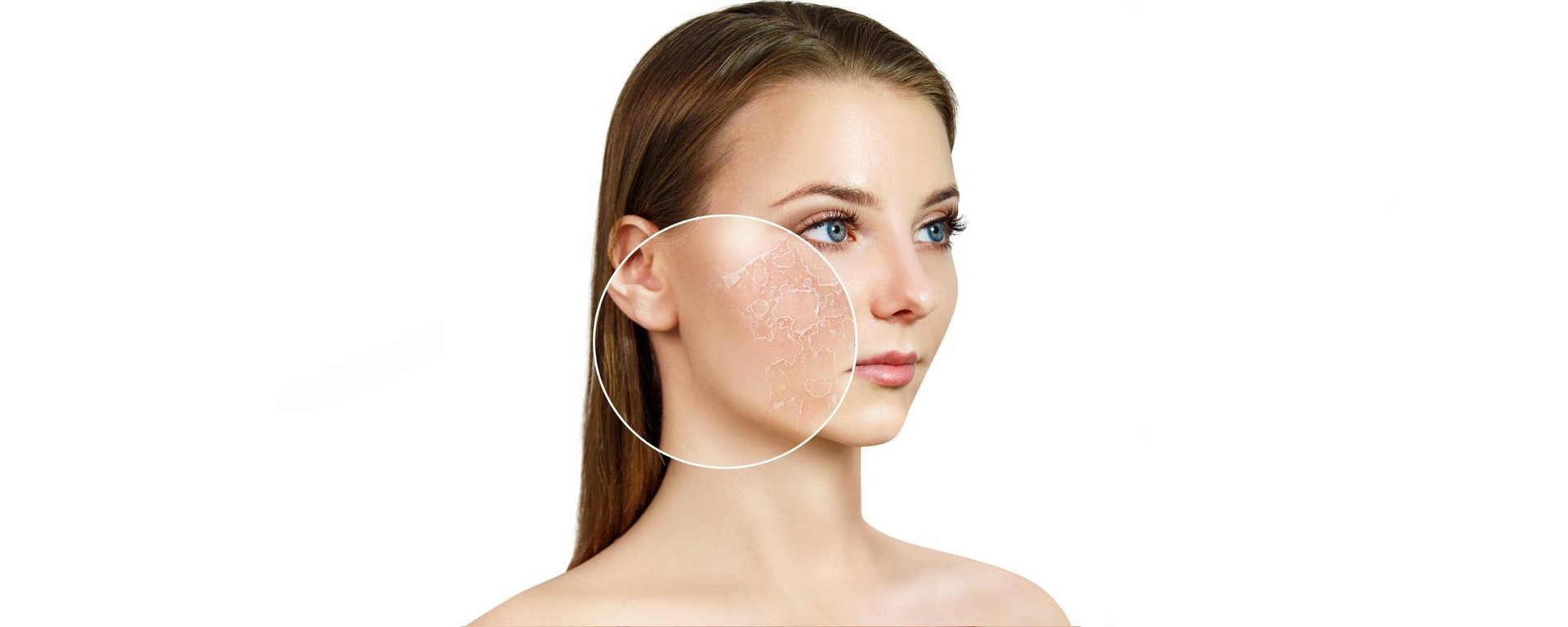 Уход за кожей лица при шелушениях