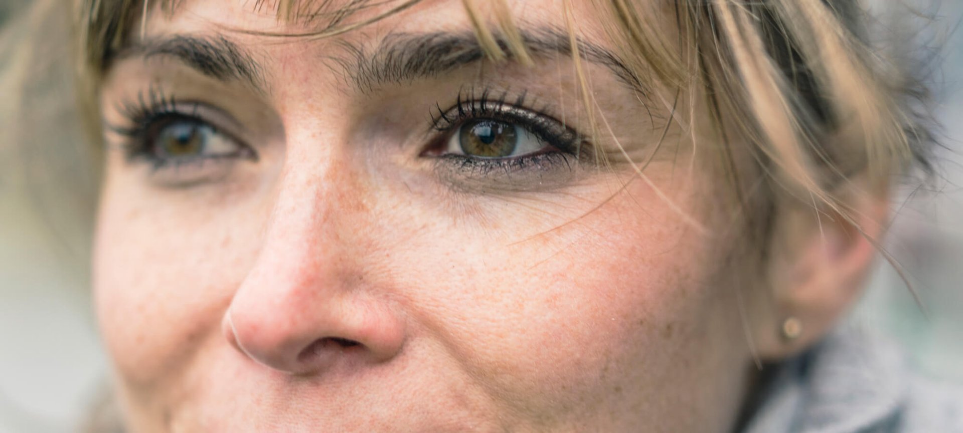 почему синяки под глазами