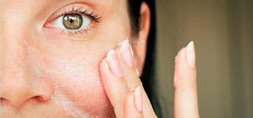 признаки сухой кожи лица