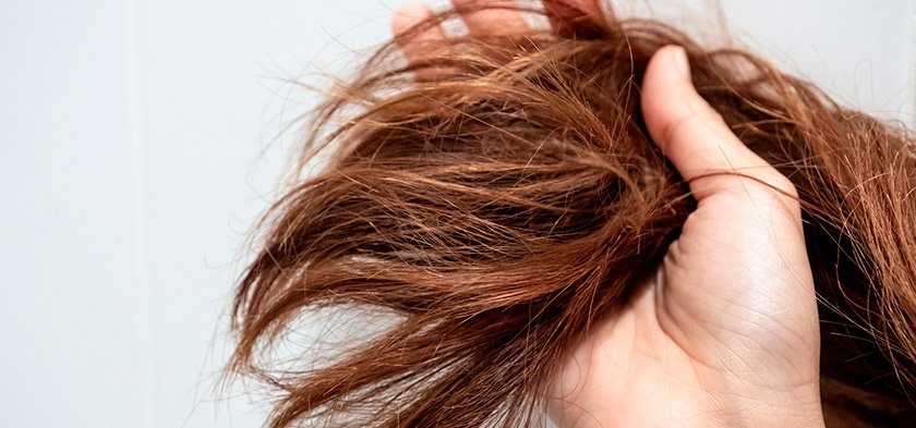 Сухие волосы: что делать, как увлажнять и восстановить - рассказывает  трихолог